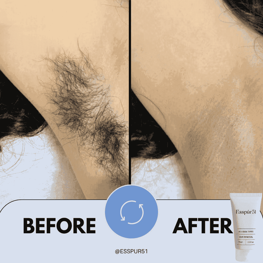 SET B - Hair Removal Cream x2 + Free Aloe Vera x1