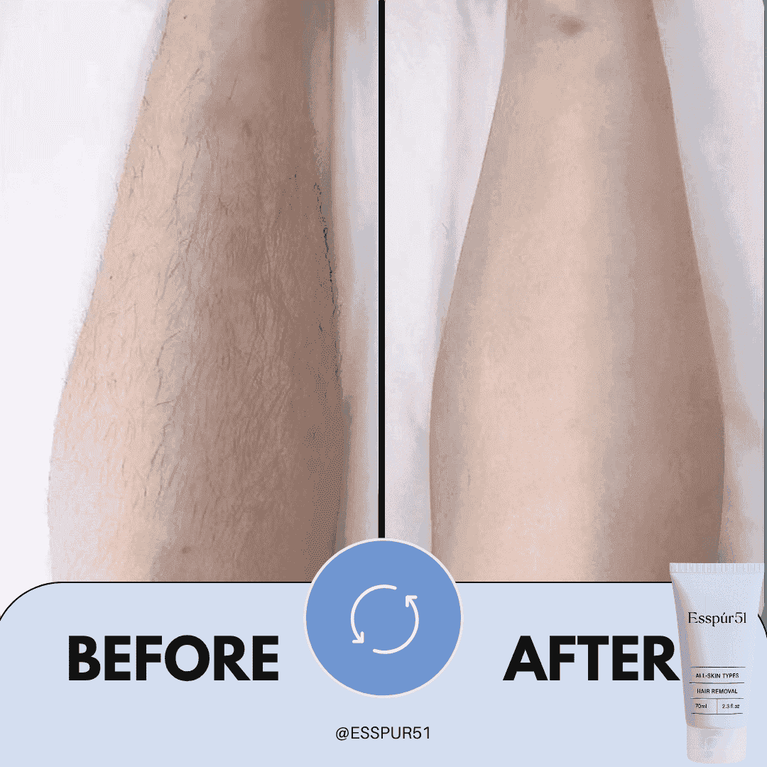 SET B - Hair Removal Cream x2 + Free Aloe Vera x1