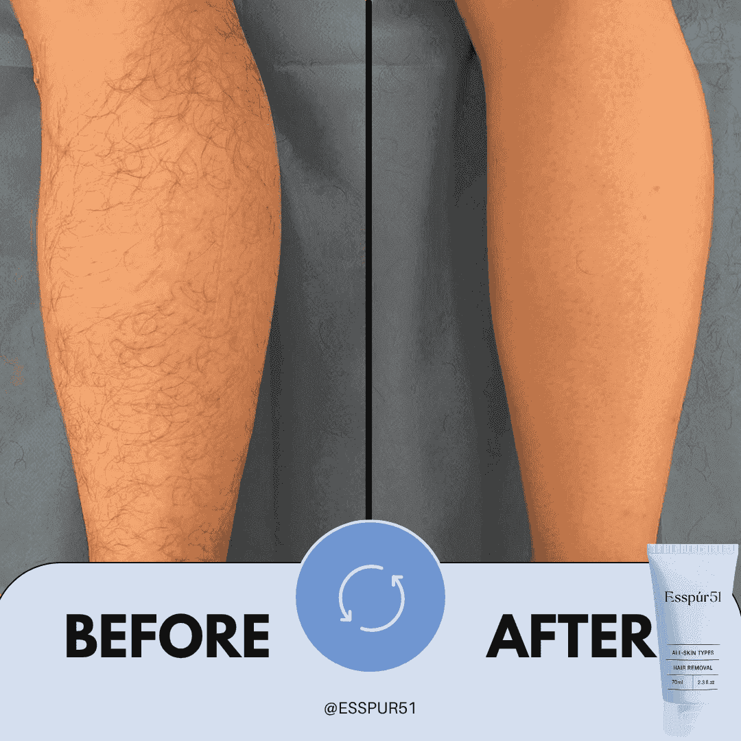 SET B - Hair Removal Cream x2 + Free Aloe Vera x1