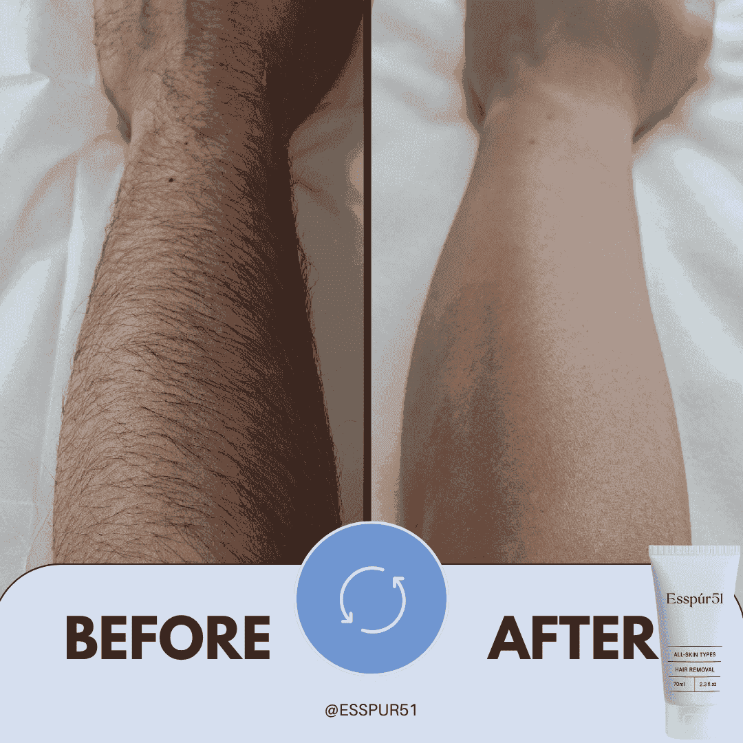 SET B - Hair Removal Cream x2 + Free Aloe Vera x1