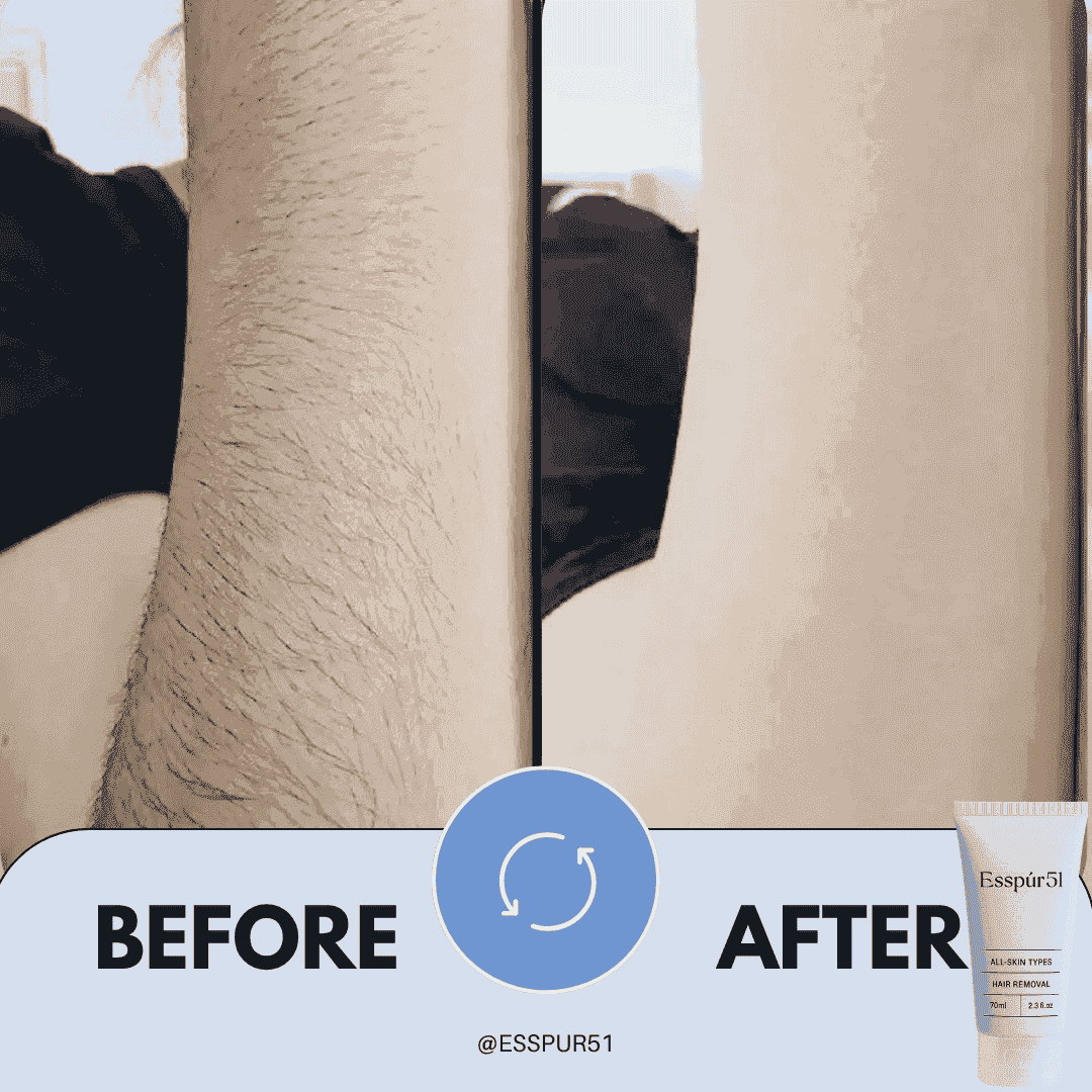 SET B - Hair Removal Cream x2 + Free Aloe Vera x1