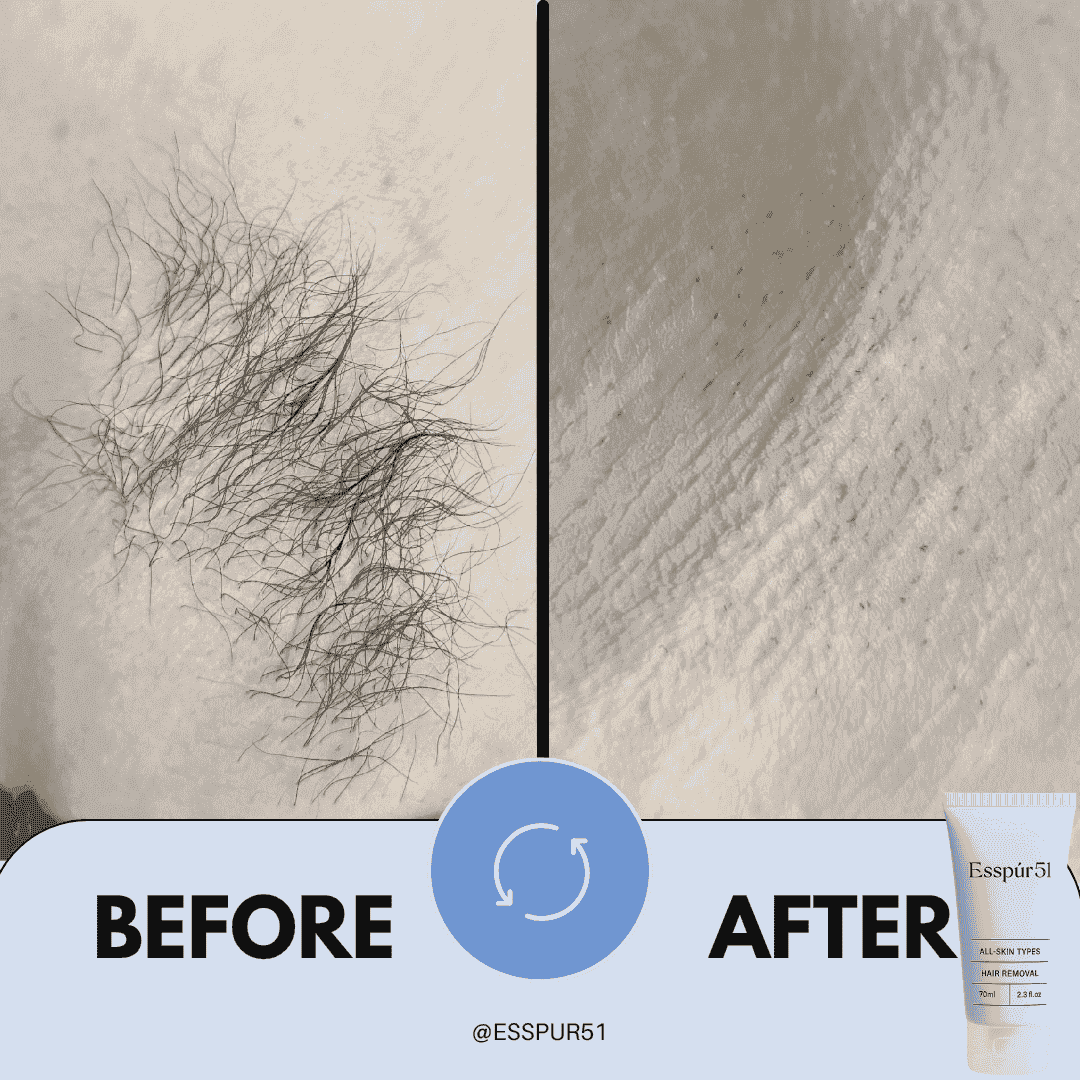 SET B - Hair Removal Cream x2 + Free Aloe Vera x1